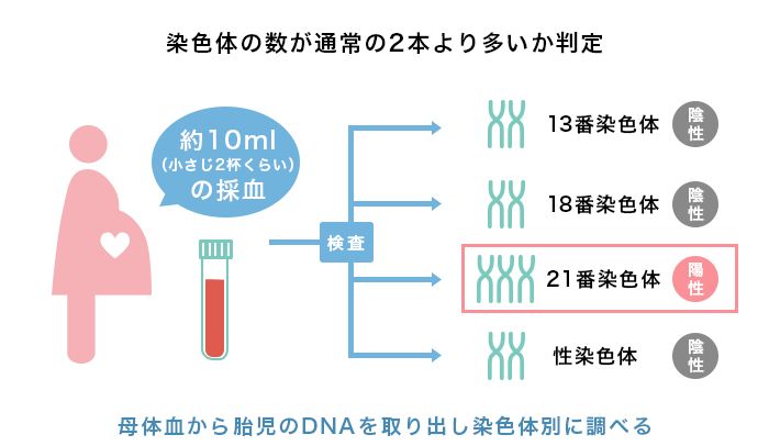 トリソミーに関する検査