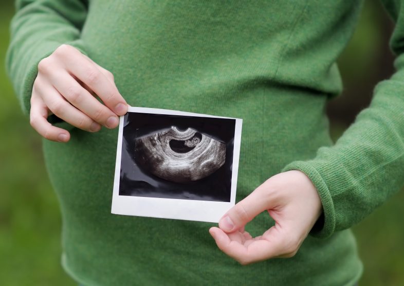 超音波による胎児スクリーニングでわかること|新型出生前診断(NIPT)とはどう違う?