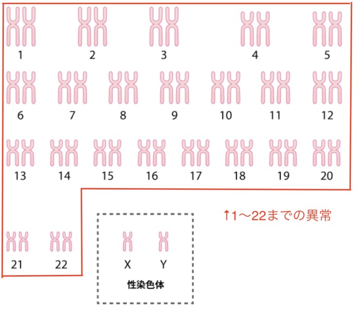 常染色体異常