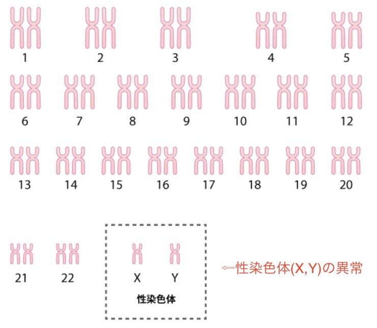 性染色体異常