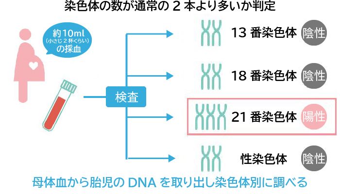 nipt検査とは