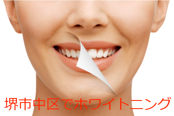 堺市中区でホワイトニングにおすすめの歯科クリニック7選